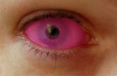 [Pink] Lentes Sclera (Par)